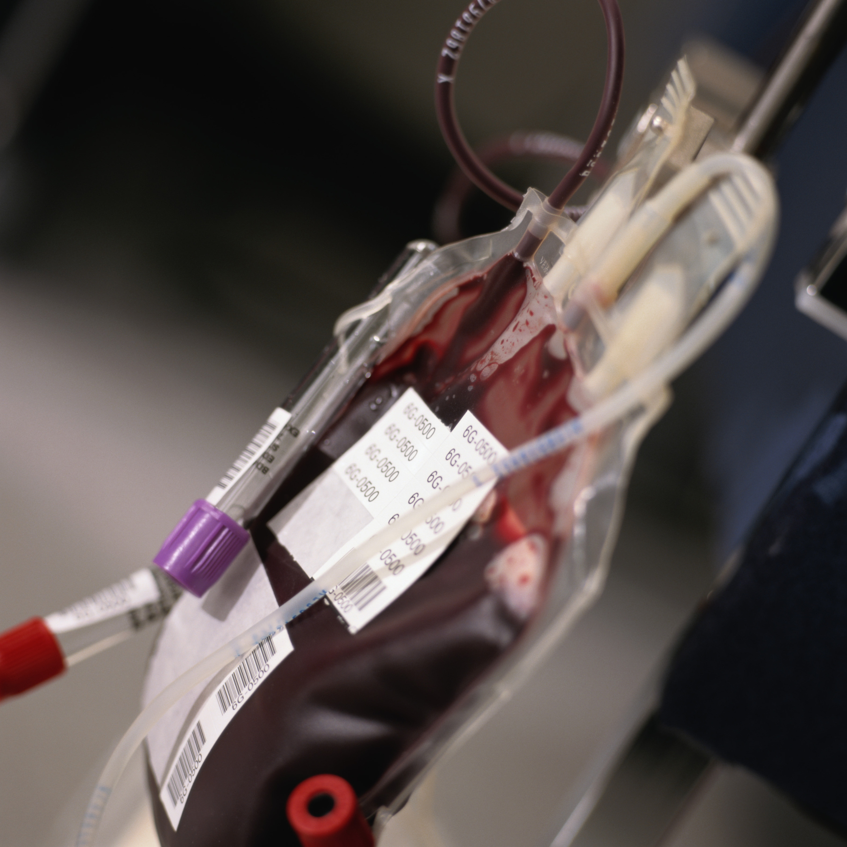 UK hospitals face ‘unprecedented’ blood shortage after cyber attack