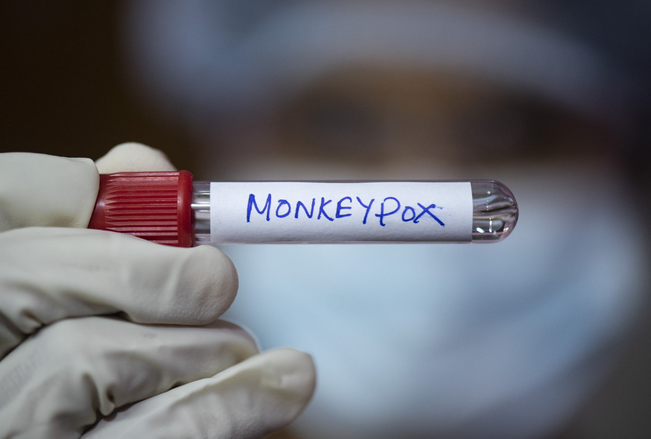 MPOX को लेकर सरकार तैयार, केंद्र ने राज्यों के साथ की बैठक