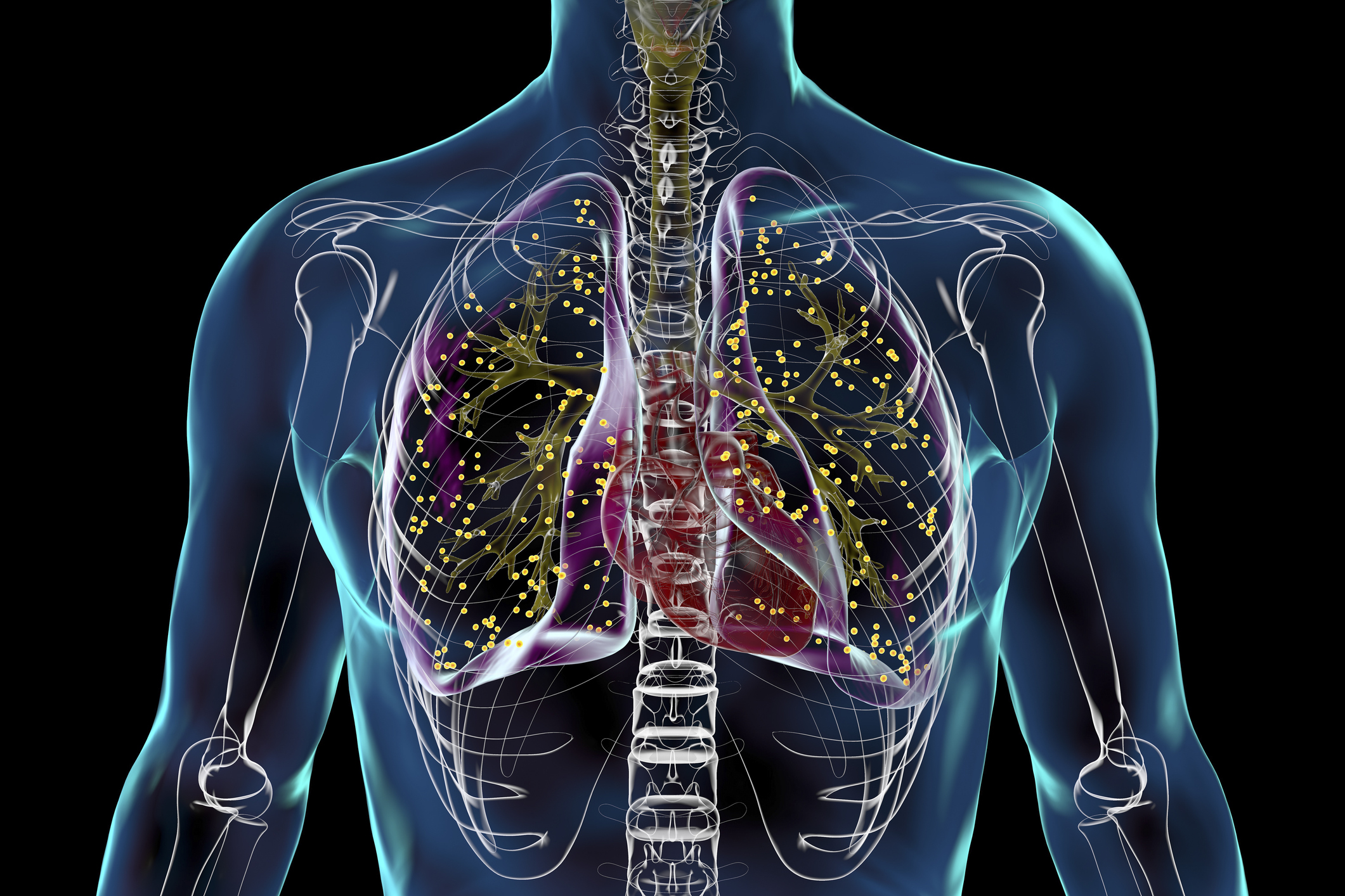 Shorter all-oral regimens for drug-resistant TB cost-effective in India: ICMR study