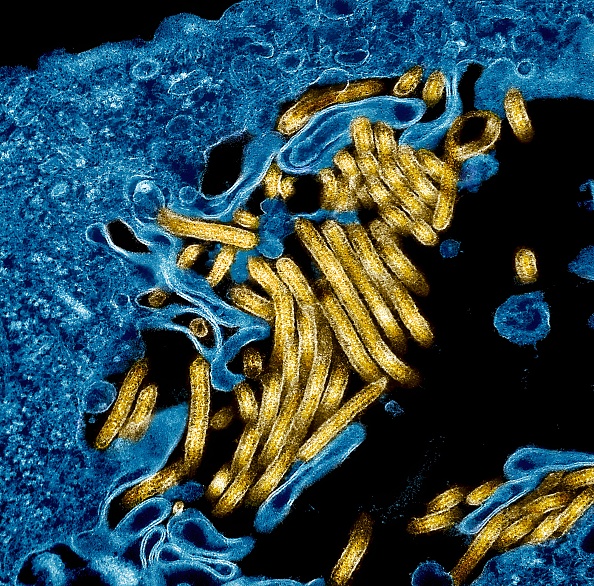 WHO declares Ebola outbreak in Congo, Uganda an emergency of international concern