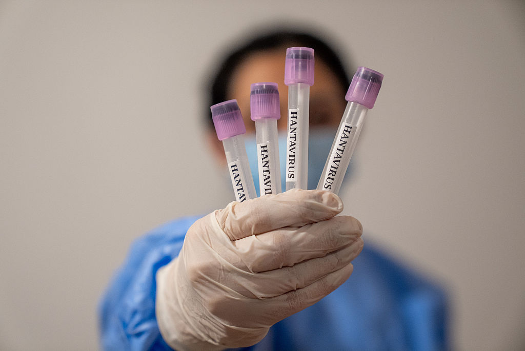 Italy says four people quarantined for hantavirus have all tested negative