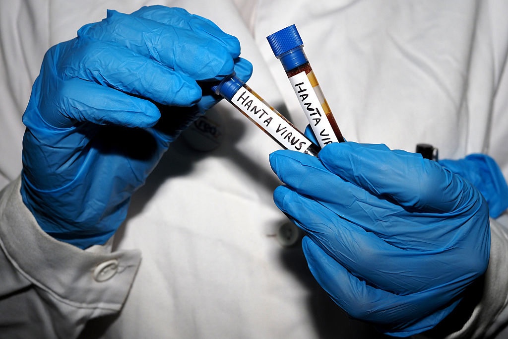 Britain gets experimental drug from Japan to bolster hantavirus response